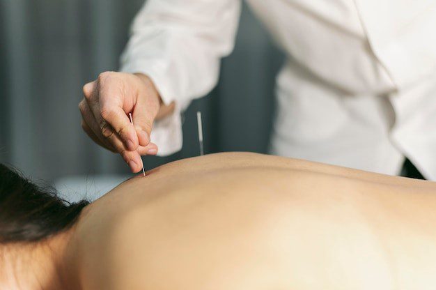 Acupuncture Treatment for Back Pain