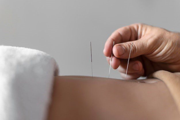 Acupuncture Treatment for Back Pain