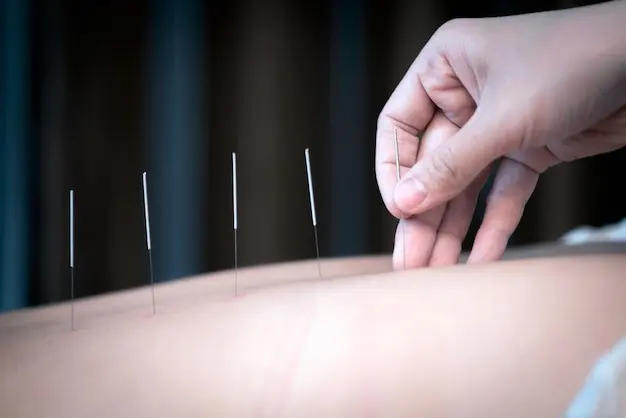 Acupuncture Treatment for Low Back Pain