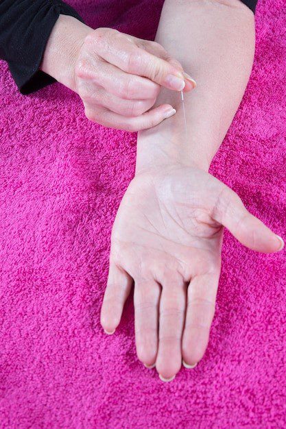 Acupuncture vs. Traditional Treatments for Hand Pain