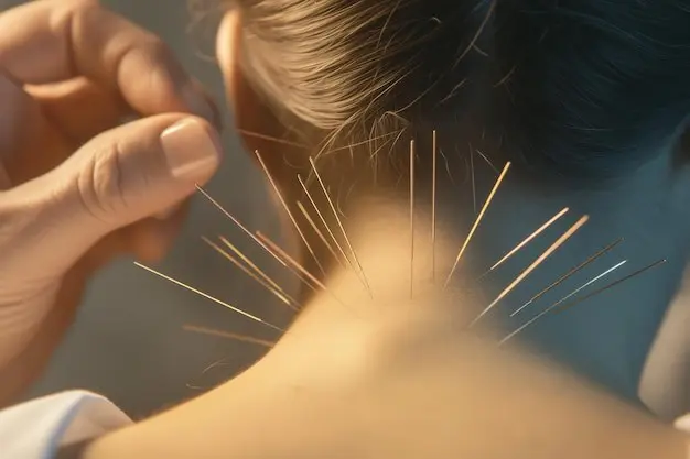 Top Strategies for Acupuncture for Neck Pain Management