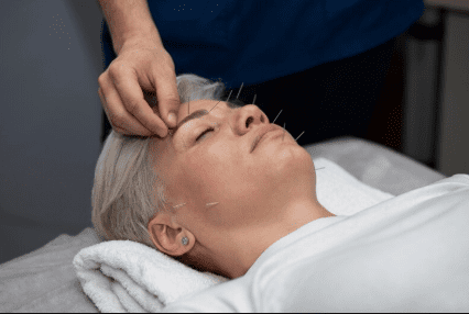 Best Acupuncture Clinics in San Francisco