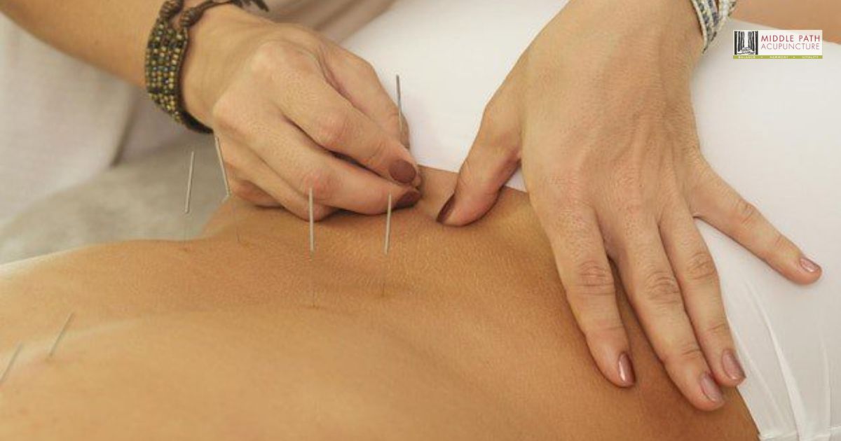 acupuncture treatment for low back pain