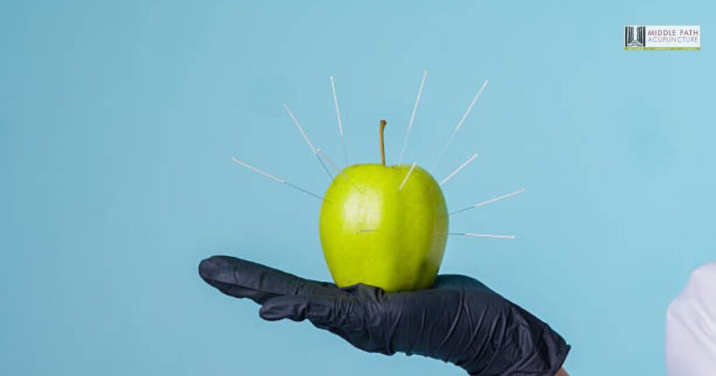 dry needling treatments San Francisco