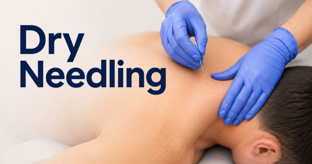 dry needling in california