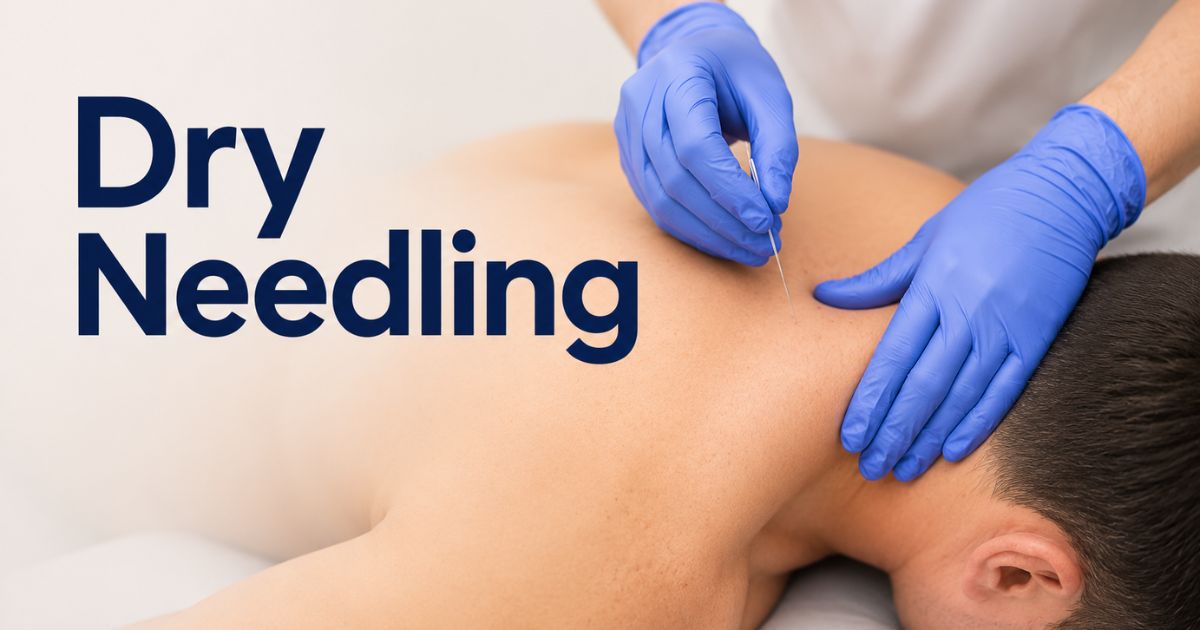 dry needling in california