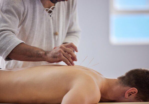 Is Acupuncture Good for Upper Back Pain?