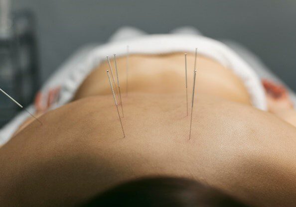 Acupuncture Points