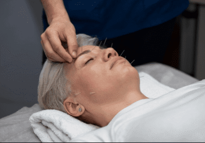 Best Acupuncture Clinics in San Francisco