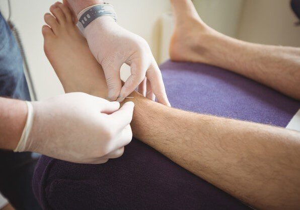 Can Acupuncture Heal Foot Pain
