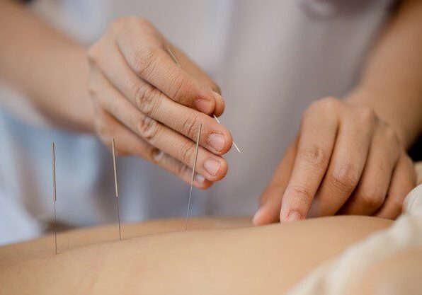Can Acupuncture Help With Lower Back Pain
