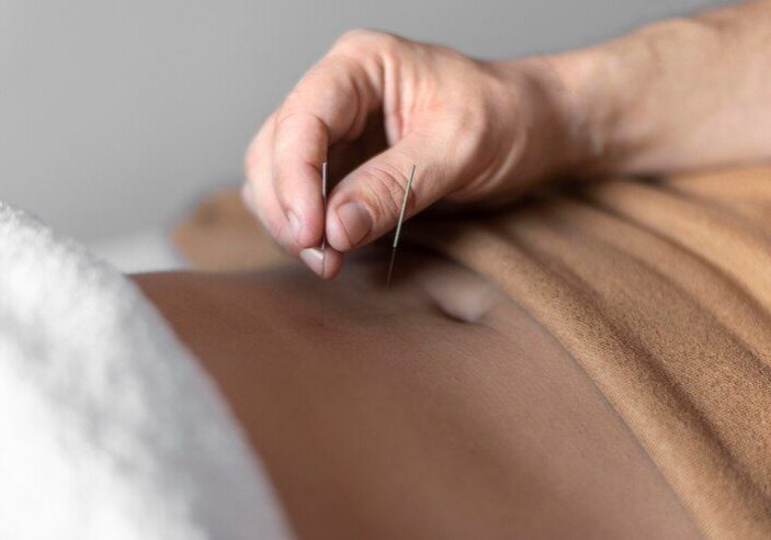 Fertility Acupuncture