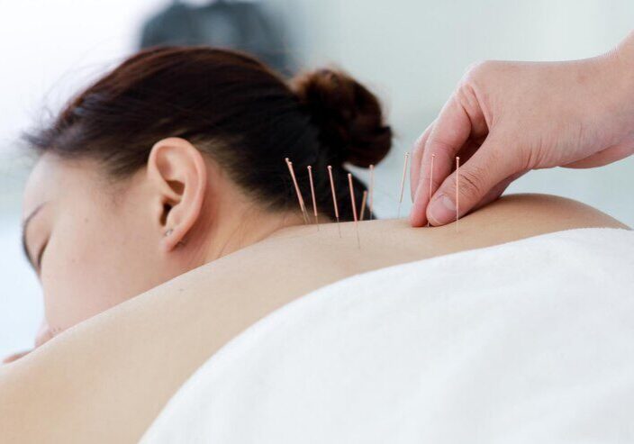 The Benefits of Acupuncture for Treating Chronic Pain