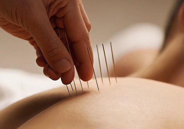 The Science Behind Acupuncture