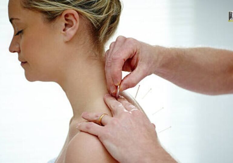 back pain acupuncture