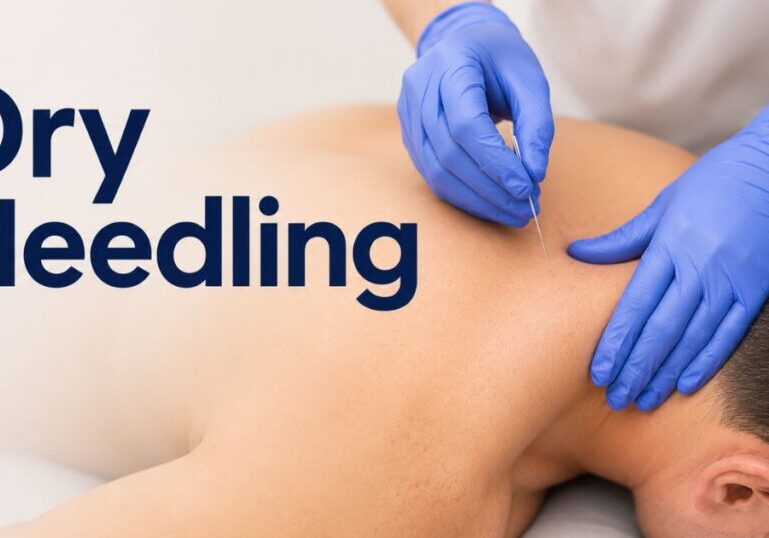 dry needling in california