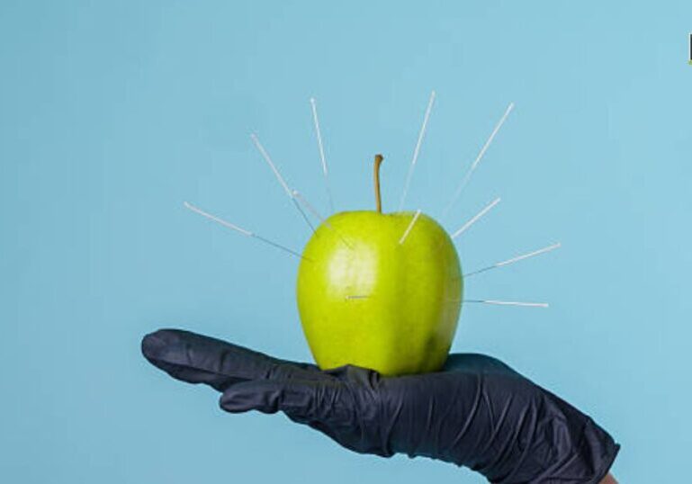 dry needling treatments San Francisco