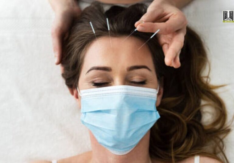 Target Migraine Triggers with Acupuncture in San Francisco